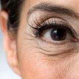 Как предотвратить появление тонких морщин под глазами?