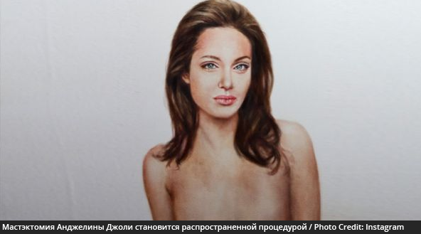 Мастэктомия, которую прошла Анджелина Джоли, становится более распространенной