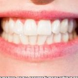 Задумывались ли вы, какими бывают зубные пломбы? 