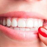 Зубні імплантати проти зубних протезів: що Вам підходить?