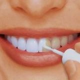 П'ять міфів про відбілювання зубів, розвіяні експертами