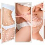 5 популярних процедур контурної пластики тіла 