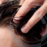 Как отшелушить кожу головы для более густых и здоровых волос