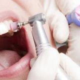 8 причин для профессиональной чистки зубов