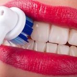 Швидкі та ефективні способи позбутися від зубного нальоту природним шляхом