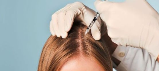 Мезотерапія для росту волосся - що потрібно знати про неї?