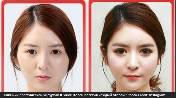 Клиники пластической хирургии Южной Кореи посетил каждый второй житель страны