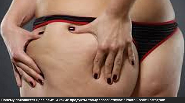 Почему появляется целлюлит, и какие продукты этому способствуют