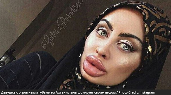 Девушка с огромными губами из Афганистана шокирует своим видом