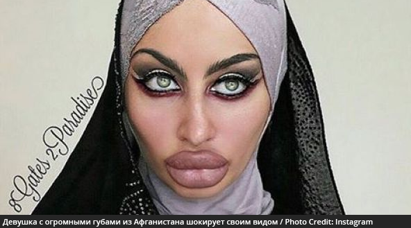 Девушка с огромными губами из Афганистана шокирует своим видом